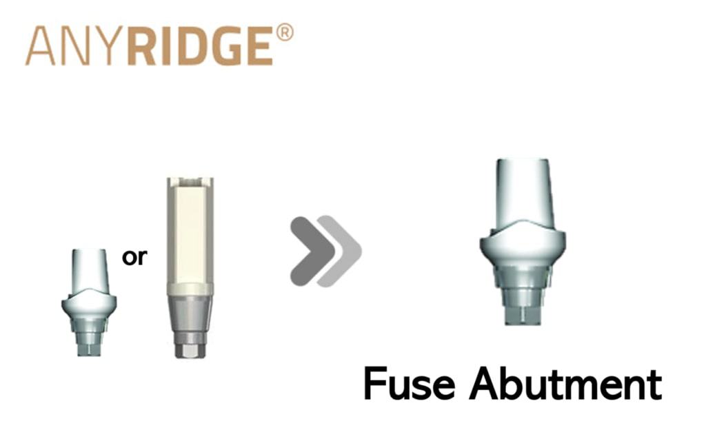 AnyRidge Fuse Abutment