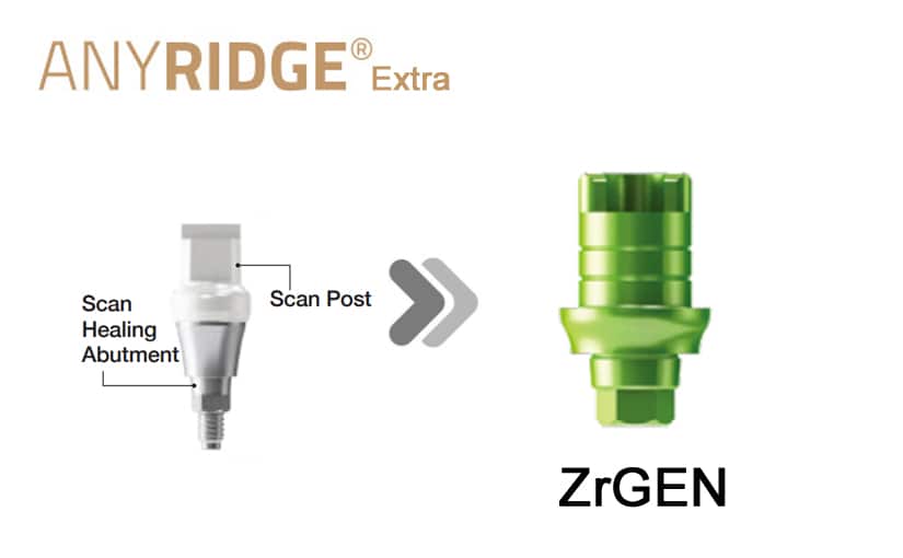 AnyRidge Extra SHA ZrGEN(Ti-base)