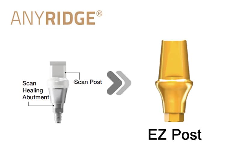 AnyRidge SHA EZ Post(Stock abutment)