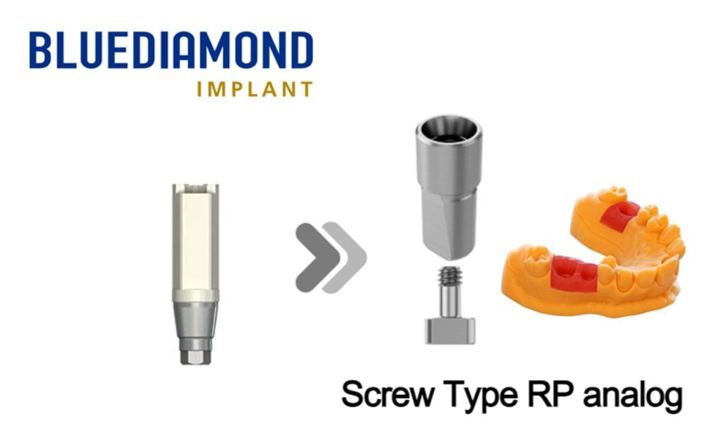 BlueDiamond RP_Screw type (3D print model)