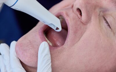 Pourquoi l’empreinte numérique change la donne en dentisterie — et comment la Medit i900/i900 classic en révèle tout le potentiel ?